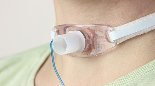 Tracheostomy Care