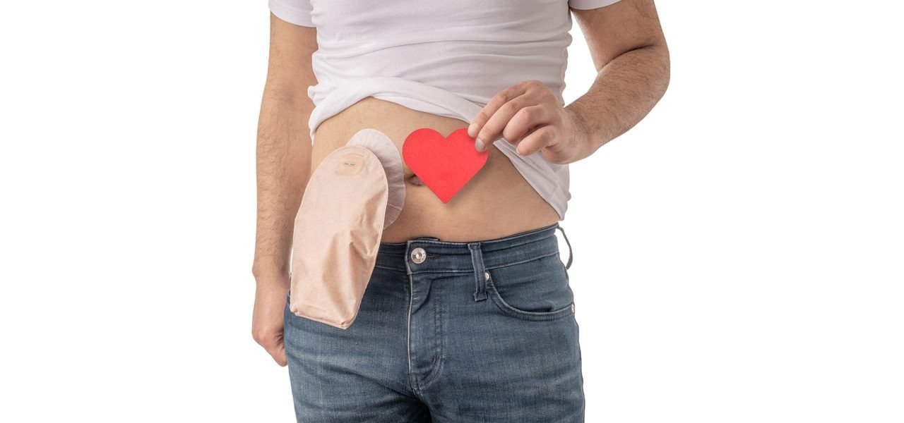 Colostomy Care